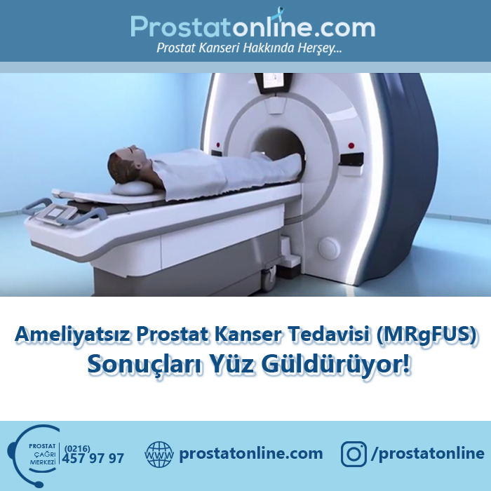 Ameliyatsız Prostat Kanser Tedavisi (MRgFUS) Sonuçları yüz güldürüyor!